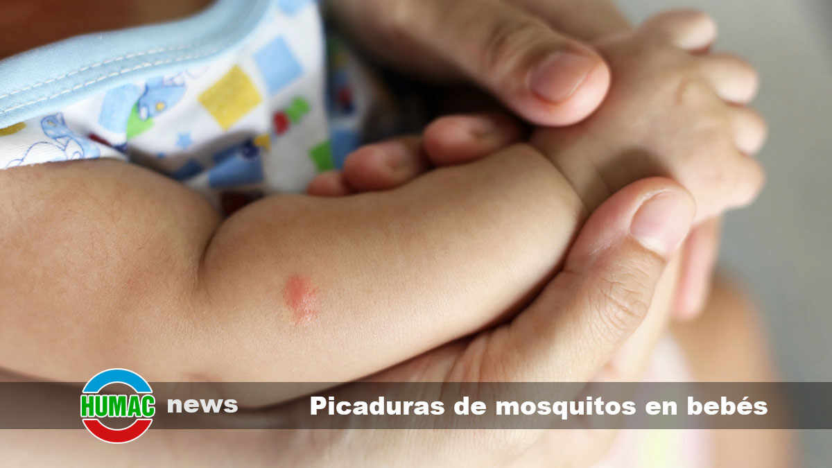 picaduras de mosquitos en bebés